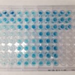 ELISA Immunoassays